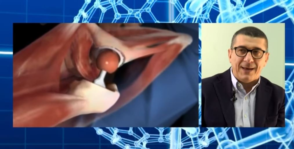 Via anteriore, l’esperienza di Flavio Bientinesi in un video